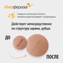 Имофераза Крем для специализированного ухода за кожей 30 г