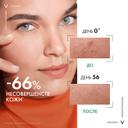 Vichy Capital Soleil UV-Clear Флюид солнцезащитный против несовершенств SPF 50+ 40 мл