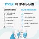 Ultrasupps Цинк 25 мг капсулы 60 шт