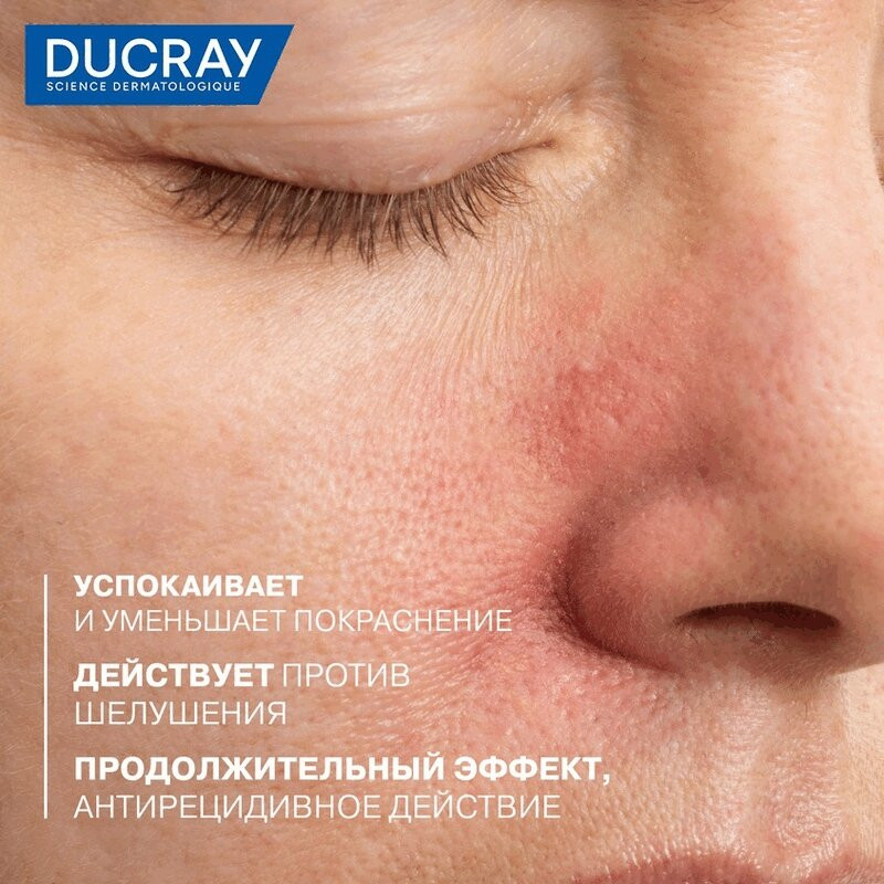 Ducray Kelual DS Крем успокаивающий снижающий шелушение кожи лица 40 мл