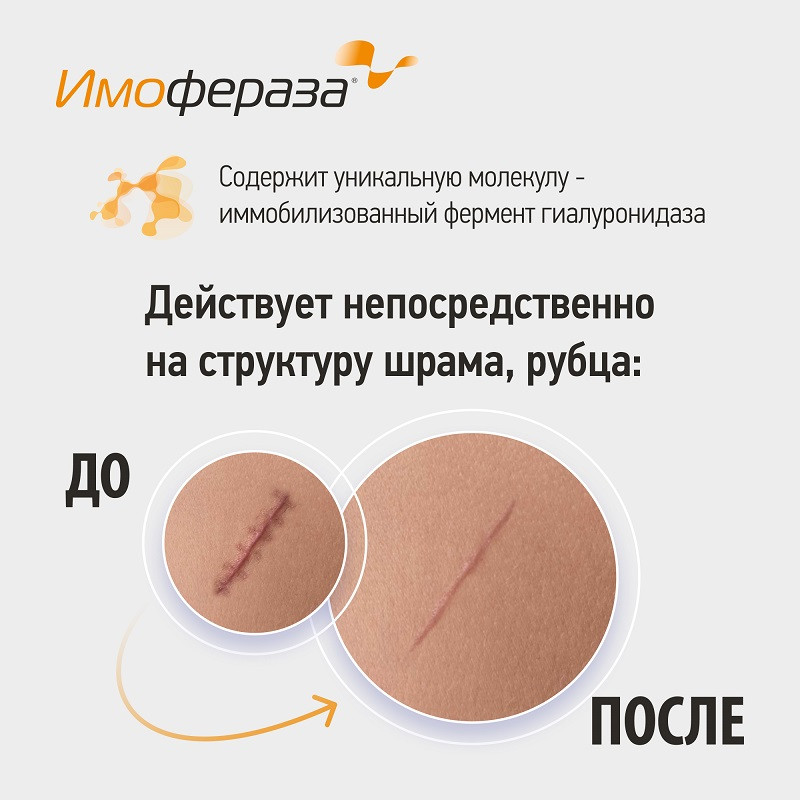 Имофераза Крем для специализированного ухода за кожей 30 г