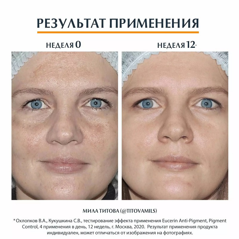 Eucerin Флюид солнцезащитный против пигментации SPF 50+ 50 мл