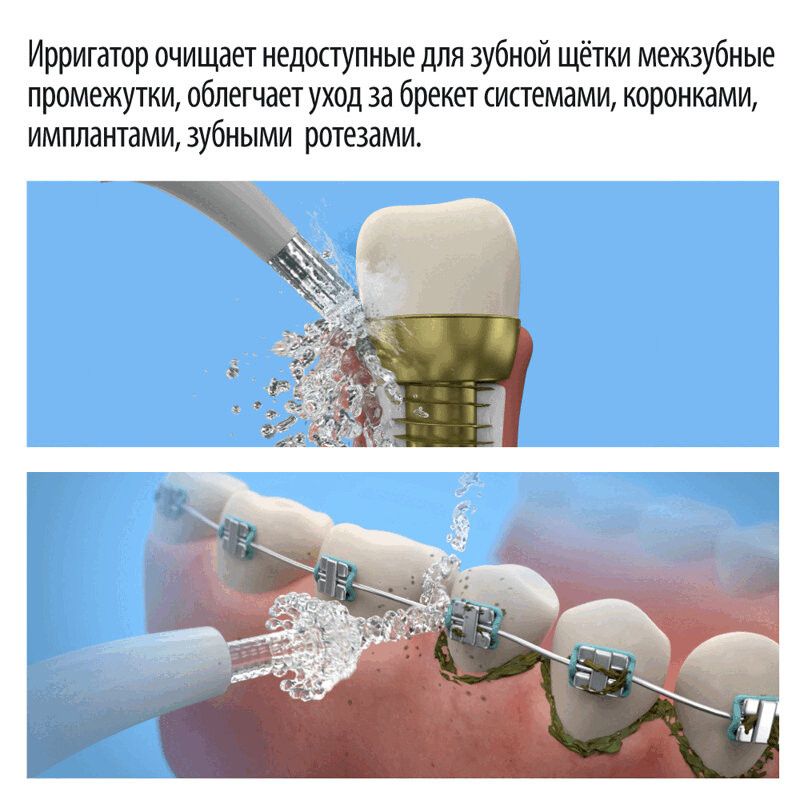 Little Doctor Aquajet Ирригатор полости рта LD-A3
