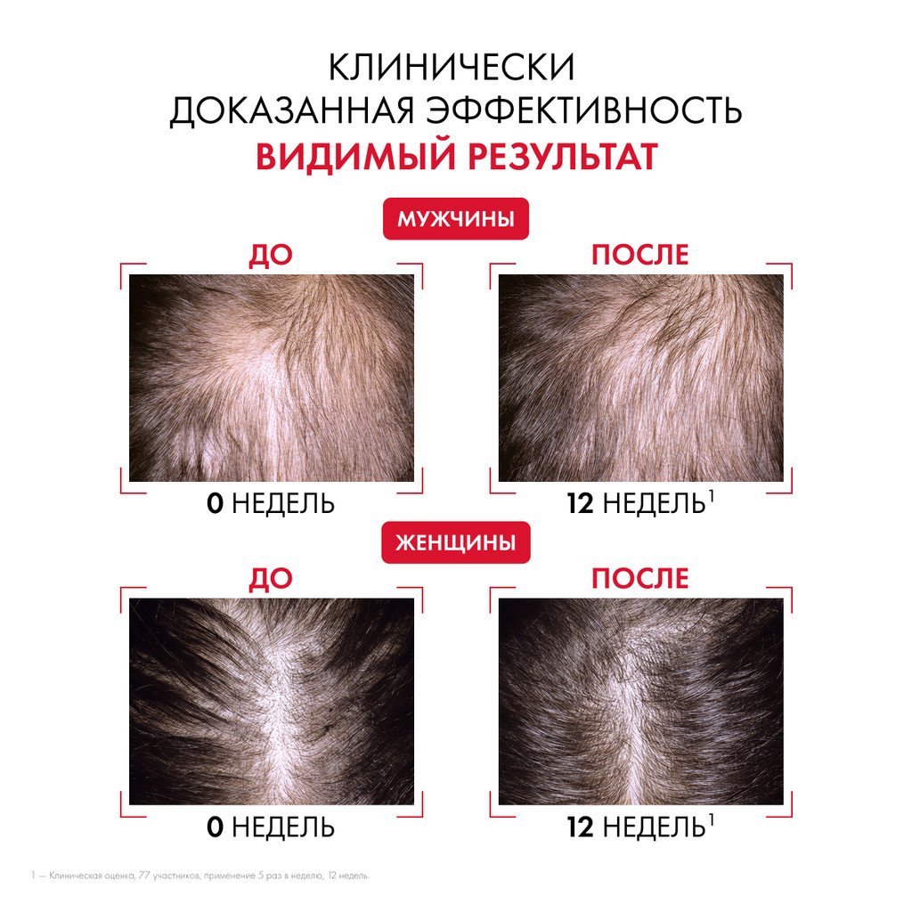 Vichy Dercos Aminexil R.E.G.E.N. Booster Сыворотка для укрепления и роста волос 90 мл