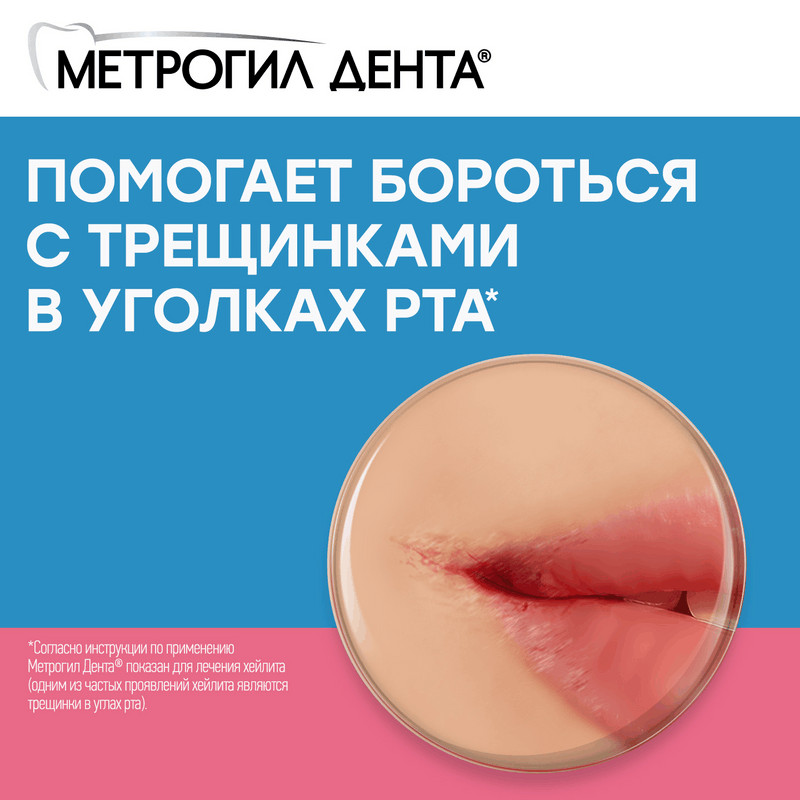 Метрогил Дента 10 мг/г+0,5 мг/г гель стоматологический 20 г