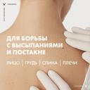 Vichy Normaderm Гель-сыворотка очищающая с эффектом пилинга 125 мл